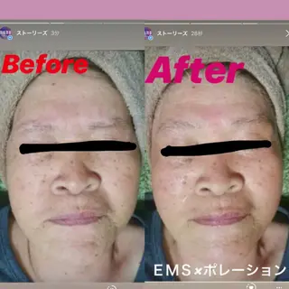 ヘアアレンジ 代表 MOMOのエステ・リラクイメージ