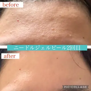 Beauty Salonheartのエステ・リラクイメージ