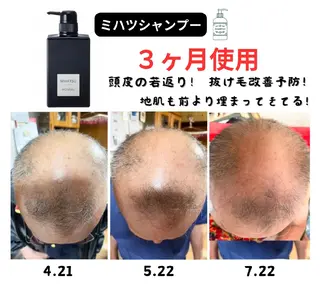 脱毛&ハーブピーリン グサロンfrereのその他イメージ
