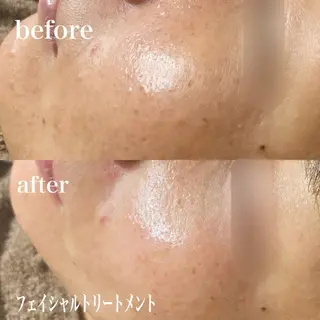 磐田|LAYLA 一番丁寧な脱毛店のエステ・リラクイメージ