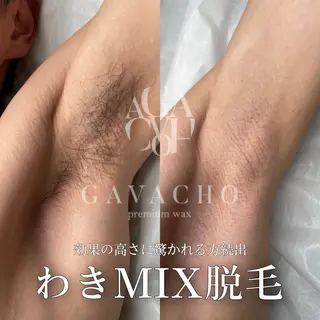 mimi 広島 安佐南区まつ毛・脱毛のマツエク・マツパデザイン