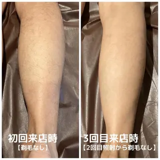 メンズ men's脱毛サロン ECXIAのエステ・リラクイメージ