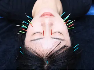 小顔矯正・美容鍼 FLOW鍼灸整体院のエステ・リラクイメージ