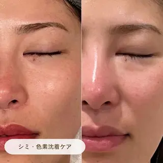 CURATED SKIN|神戸三宮のエステ・リラクイメージ