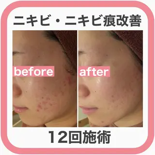 ミディアム カラー パーマ ヘアアレンジ メンズ キッズ ネイル マツエク・マツパ ニキビ・肌質改善専門 ♡人生が変わるサロンのエステ・リラクイメージ