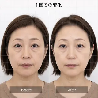 小顔・たるみ専門 DAZZLEのエステ・リラクイメージ