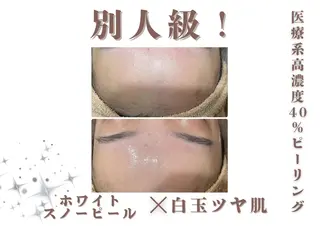 🎀レイビス🎀 銀座店オノのエステ・リラクイメージ