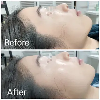 肌質改善Beauty salon Renのエステ・リラクイメージ