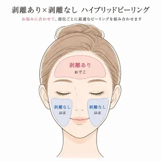 ハーブピーリング専門 MOKAのエステ・リラクイメージ