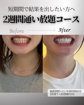歯科提携エラン ホワイトニング一社店のその他イメージ
