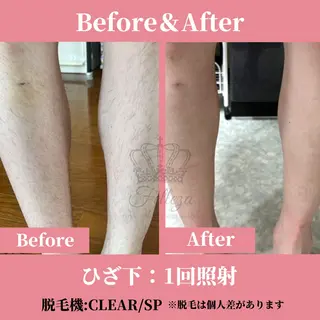 メンズ 有人型セルフサロン 脱毛/痩身/美顔のエステ・リラクイメージ
