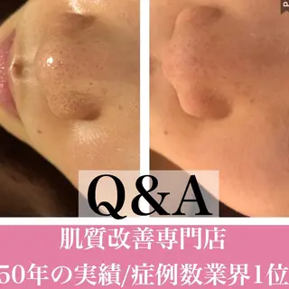 セミロング カラー パーマ ヘアアレンジ メンズ キッズ ネイル マツエク・マツパ ニキビ・肌質改善専門 ♡人生が変わるサロンのエステ・リラクイメージ