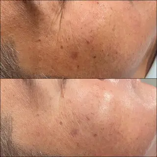 LiZA エステティックサロンのエステ・リラクイメージ