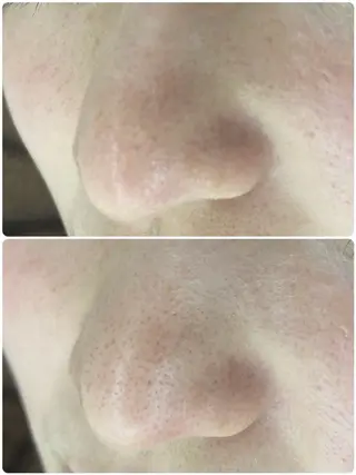 メンズ 美 Faceのエステ・リラクイメージ