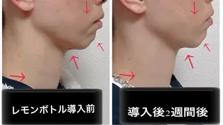 小顔と腸の専門店 ラクーラビューティーのエステ・リラクイメージ
