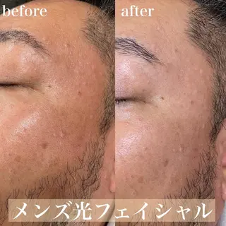 メンズ mish eyebrowのエステ・リラクイメージ