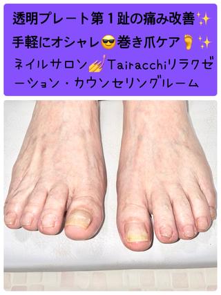 ネイル Tairacchi タイラッチのネイルデザイン