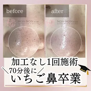 NON-NONプラス 大人の本気痩身のエステ・リラクイメージ