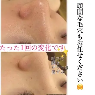 ミディアム カラー パーマ ヘアアレンジ メンズ ネイル マツエク・マツパ ニキビ・肌質改善専門 ♡人生が変わるサロンのエステ・リラクイメージ