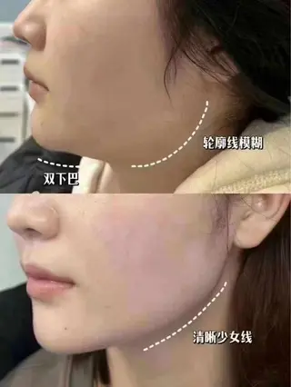 ネイル 愛維美水光専門店 川崎彩鳳のエステ・リラクイメージ