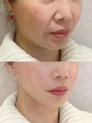ネイル 愛維美水光専門店 川崎彩鳳のエステ・リラクイメージ