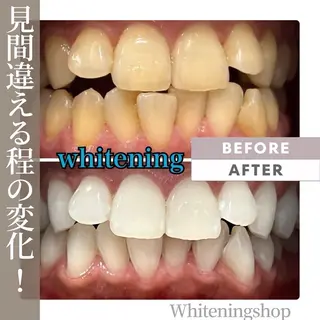 ホワイトニング ショップ津店のその他イメージ