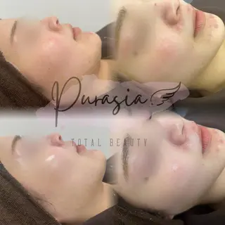 🪞Purasia. 🫧韓国肌管理💎のエステ・リラクイメージ