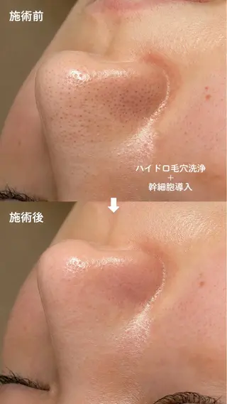 トータルボディケア chouchouのその他イメージ