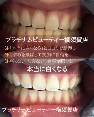 プラチナム ビューティー横須賀店のその他イメージ