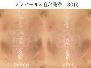 韓国肌管理/眉毛専門 Ranan(ラナン)の眉毛・アイブロウイメージ