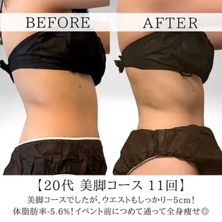 あみ|痩身の最先端 よもぎ蒸しサロン大塚のエステ・リラクイメージ