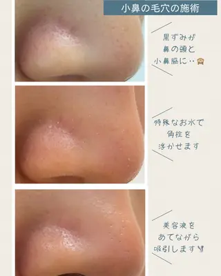 [毛穴•肌質改善] フェイシャル専門のヘアスタイル