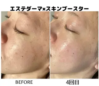 佐々木 麻裕のエステ・リラクイメージ