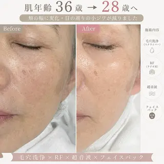 Balance facialのその他イメージ