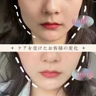 愛維美水光美肌専門店 メンズレディースokのエステ・リラクイメージ