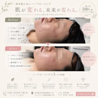 ザ ハーブスキンのエステ・リラクイメージ