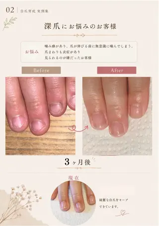 ネイル 木村 千晴のネイルデザイン