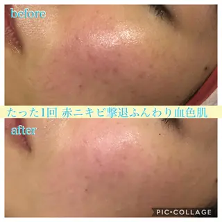 セミロング カラー パーマ ヘアアレンジ キッズ ネイル マツエク・マツパ EnsorClair 代表 野口真央のエステ・リラクイメージ
