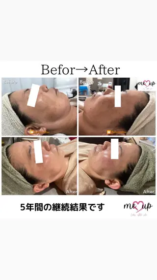 Meupニキビ専門店 背中/ハーブ/肌管理のその他イメージ