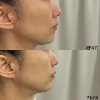 エステサロン Venusのその他イメージ