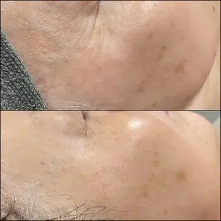 LiZA エステティックサロンのエステ・リラクイメージ