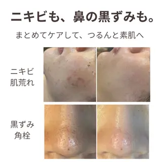 leolo武蔵浦和 肌質改善&脱毛のエステ・リラクイメージ
