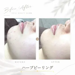 《 肌質×美肌 》 addissimoのエステ・リラクイメージ