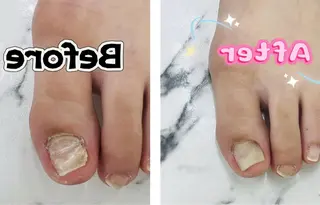 ネイル bijou nails 蓮のネイルデザイン