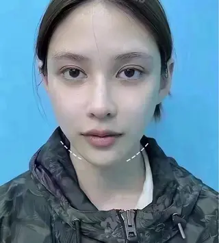 ネイル 愛維美水光専門店 川崎彩鳳のエステ・リラクイメージ
