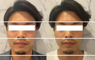 MEDI BEAUTEのエステ・リラクイメージ