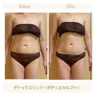 小顔・たるみ改善 ラディアントミューズのエステ・リラクイメージ