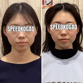 小顔矯正Speed KOGAO渋谷本店のエステ・リラクイメージ