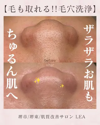 Lea堺東　　眉毛| 毛穴洗浄|顔WAXの眉毛・アイブロウイメージ