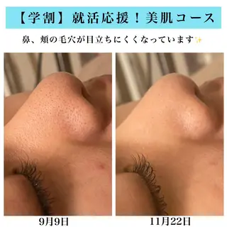 Bellesthe (ベルエステ)のエステ・リラクイメージ
